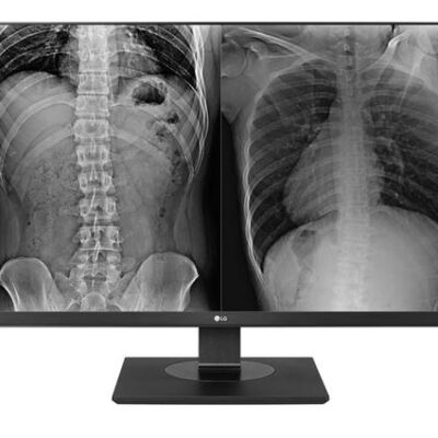 Black Friday Monitor medical profesional IPS LED LG 27inch 27HJ713C-B