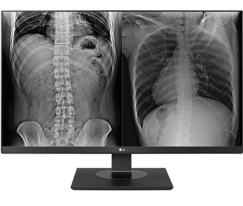 Black Friday Monitor medical profesional IPS LED LG 27inch 27HJ713C-B